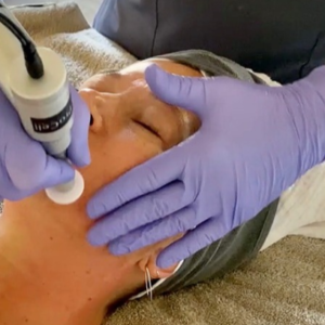 Online Integrative Microneedling for Acupuncturist Certification (11 NCBAHM CEU'S, 13 CA CEU'S)